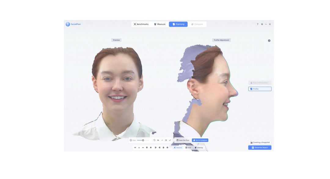 CONSULFACE: A REVOLUTIONARY TOOL FOR FACIAL PLANNING SIMULATION