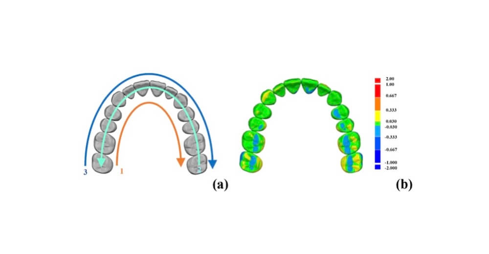 INFLUENCE OF OPERATOR EXPERIENCE ON THE COMPLETE-ARCH ACCURACY AND TIME-BASED EFFICIENCY OF THREE INTRAORAL SCANNERS – SCIENCEDIRECT PORTAL