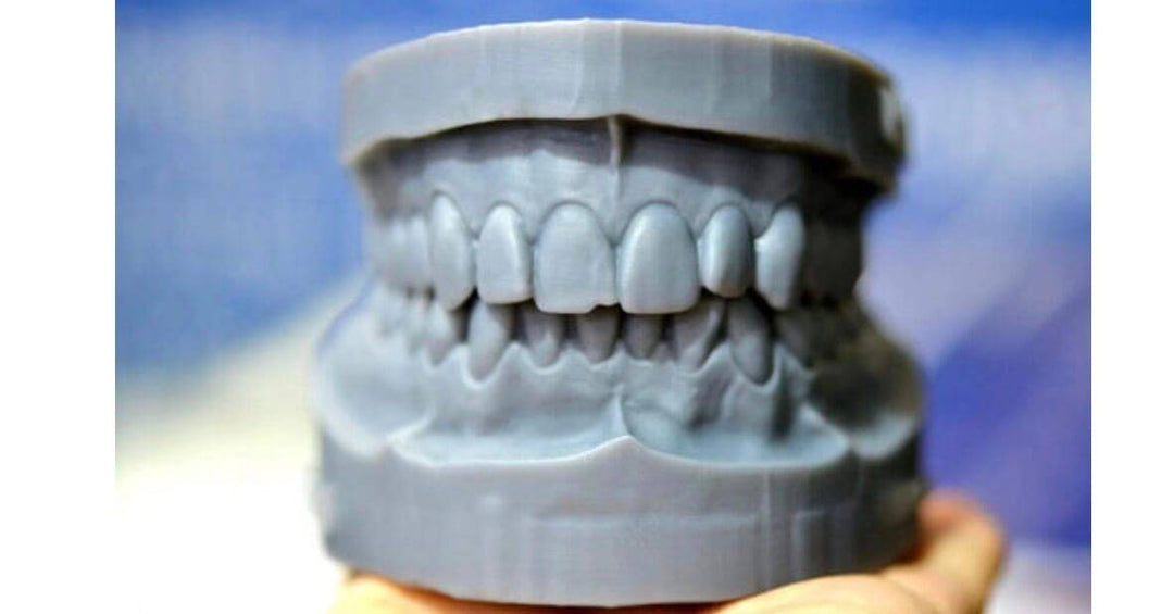 Why dental 3D printing is becoming more popular in dentistry?