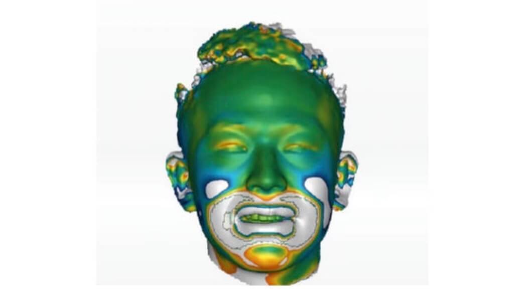 AESTHETIC RESTORATION CASE EMPOWERED BY DIGITAL VIRTUAL PATIENT