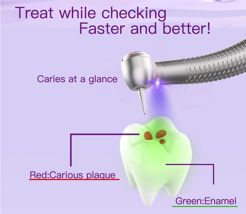 Coxo CX207-F H65 Caries detection handpiece with generator(New release)