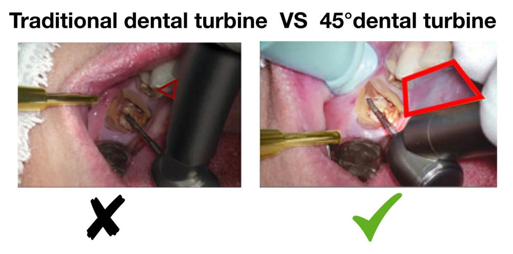 ADAE 45° LED dental turbine