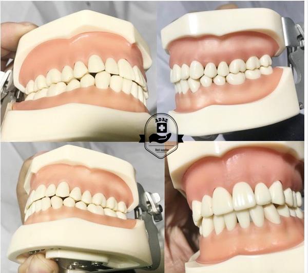 ADAE AD032 dental study model - ADAE Dental Online Store