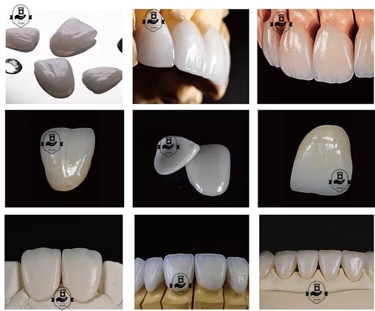 ADAE Dental Glass Ceramic Emax - ADAE Dental Online Store
