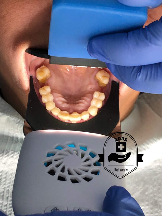 ADAE dental intraoral LED fog free photo system kit - ADAE Dental Online Store