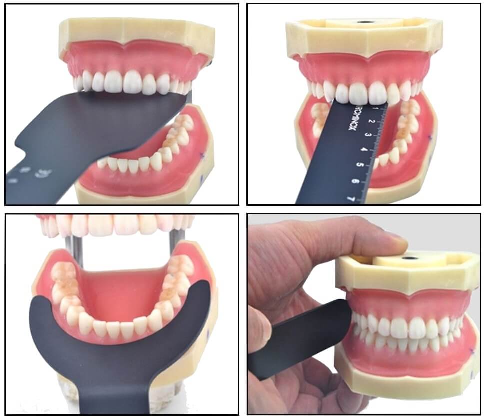 ADAE dental photo contrast black boards set - ADAE Dental Online Store