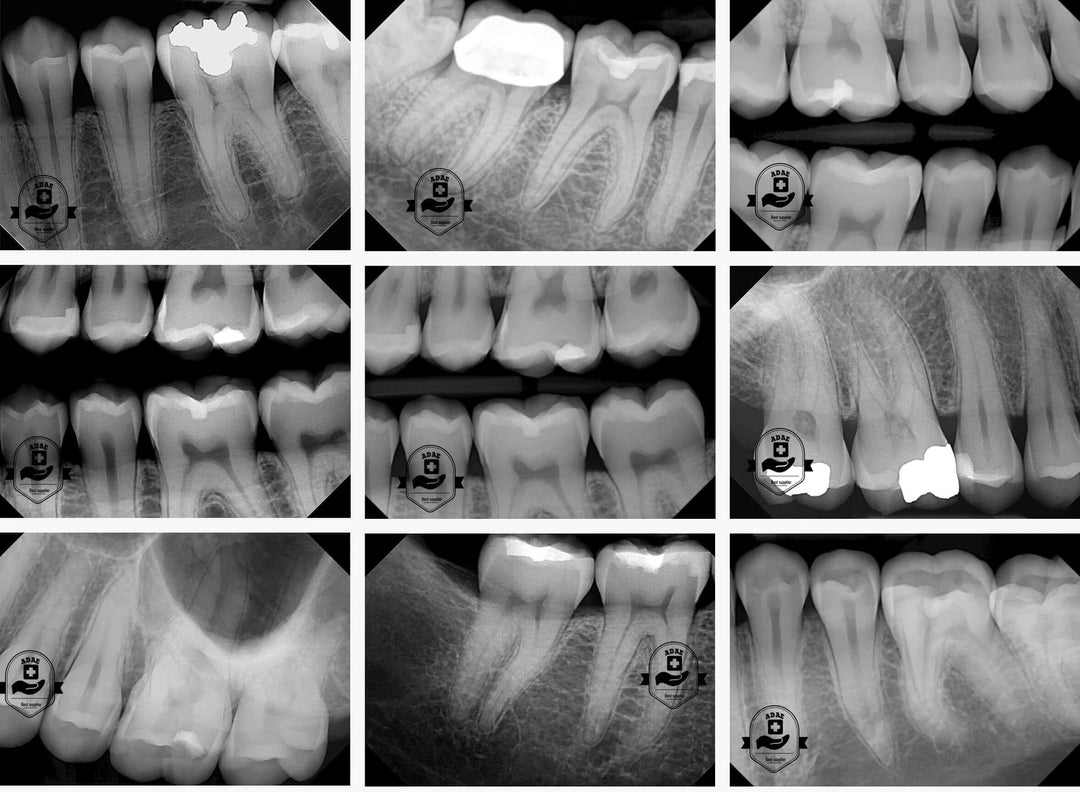 ADAE Refine dental X-Ray sensor (R1-R2) with Twain Driver(Upgraded version)
