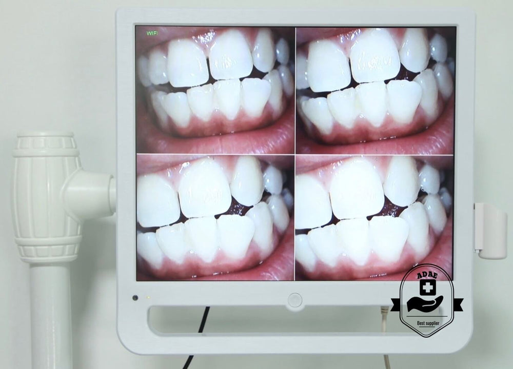 ADAE Sony probe Intra-Oral camera with 17 inch monitor - ADAE Dental Online Store