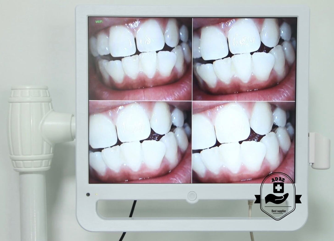 ADAE Sony probe Intra-Oral camera with 17 inch monitor - ADAE Dental Online Store