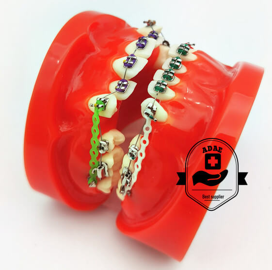 ADAE orthodontic tooth model with metal bracket
