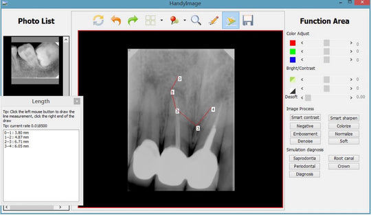 Handy X ray sensor HDR500-600-Twain driver (Upgraded version) - ADAE Dental Online Store