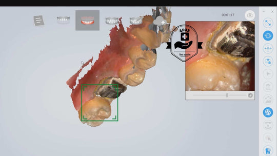 SHINING 3D Aoralscan intraoral scanner