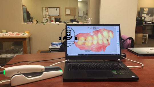 SHINING 3D Aoralscan intraoral scanner (New release only from ADAE) - ADAE Dental Online Store