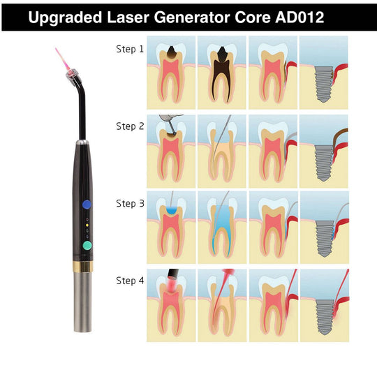 ADAE AD012 Dental Laser Pen (with ADAE original laser core) - ADAE Dental Online Store