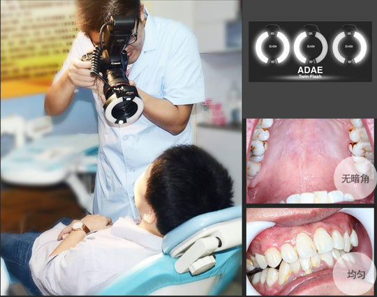 TTL Micro Ring Flash Compatible With (Nikon and Canon) - ADAE Dental Online Store