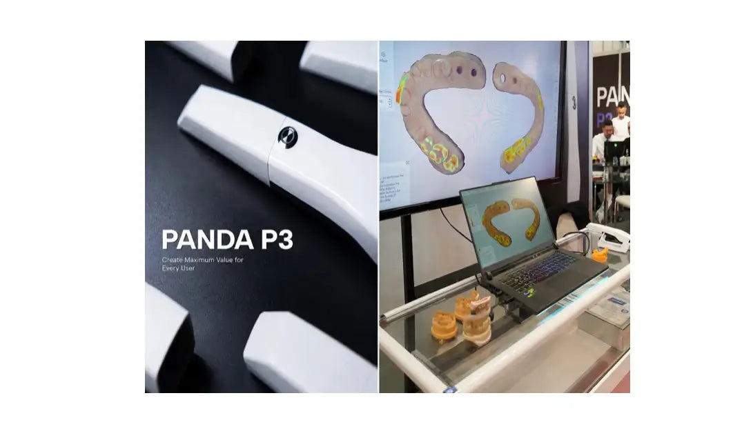 Why the Panda P3 Intraoral scanner Is a Winner in Modern Digital Dentistry