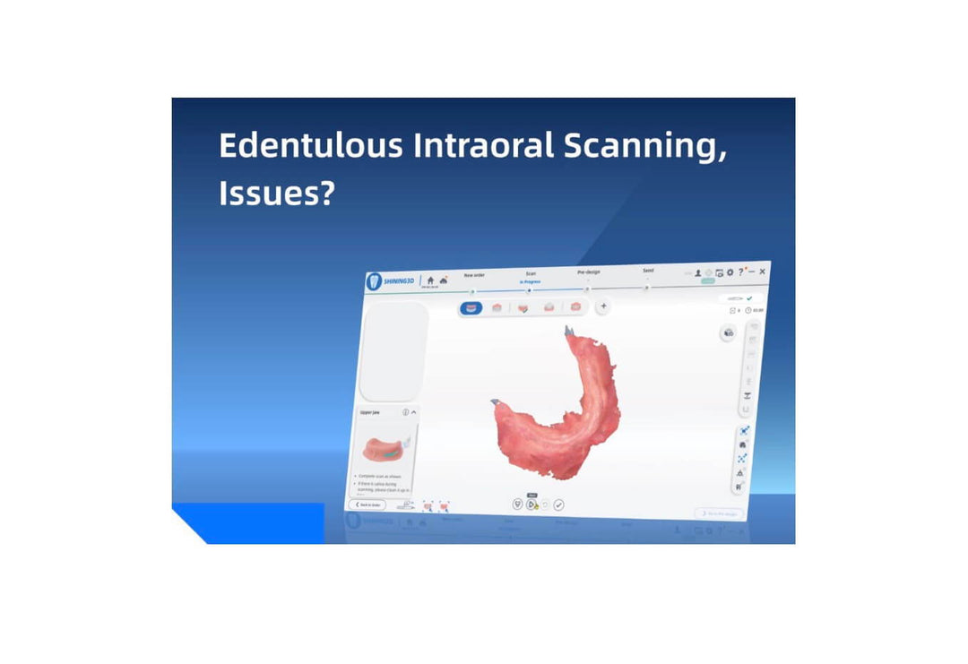 EDENTULOUS INTRAORAL SCANNING, ISSUES?