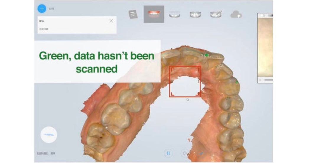 AORALSCAN: GET COMPLETE SCAN DATA WITH TOOTH COLOR FUNCTION