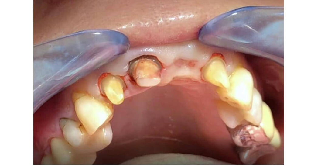 EFFECTIVE DENTAL IMPRESSION RM