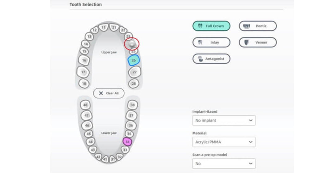 THREE IMPROVEMENTS IN IMPLANT MADE BY AORALSCAN