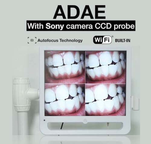 Intra-oral cameras