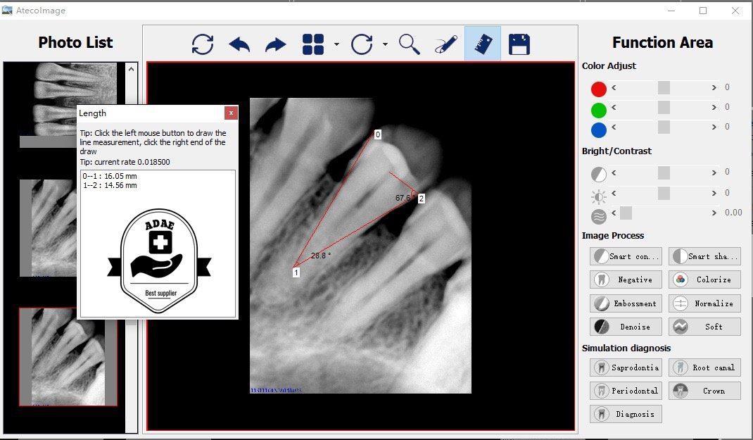 ATECO X-Ray Sensor Driver Software & Calibration Files – Sensor Not Included
