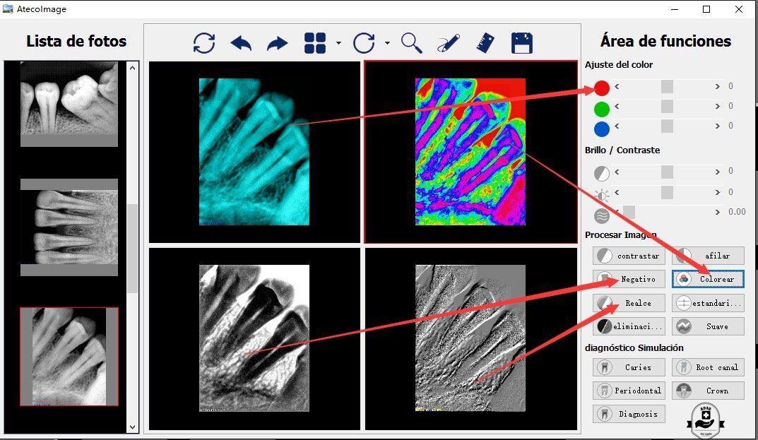 ATECO X-Ray Sensor Driver Software & Calibration Files – Sensor Not Included