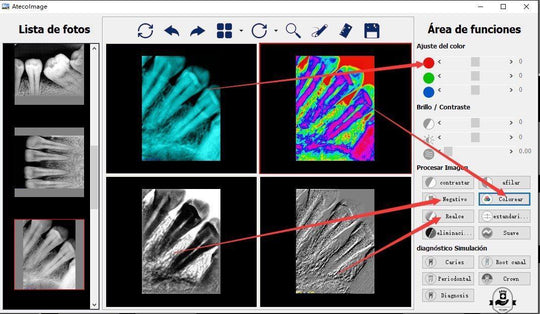 ATECO X-Ray Sensor Driver Software & Calibration Files – Sensor Not Included