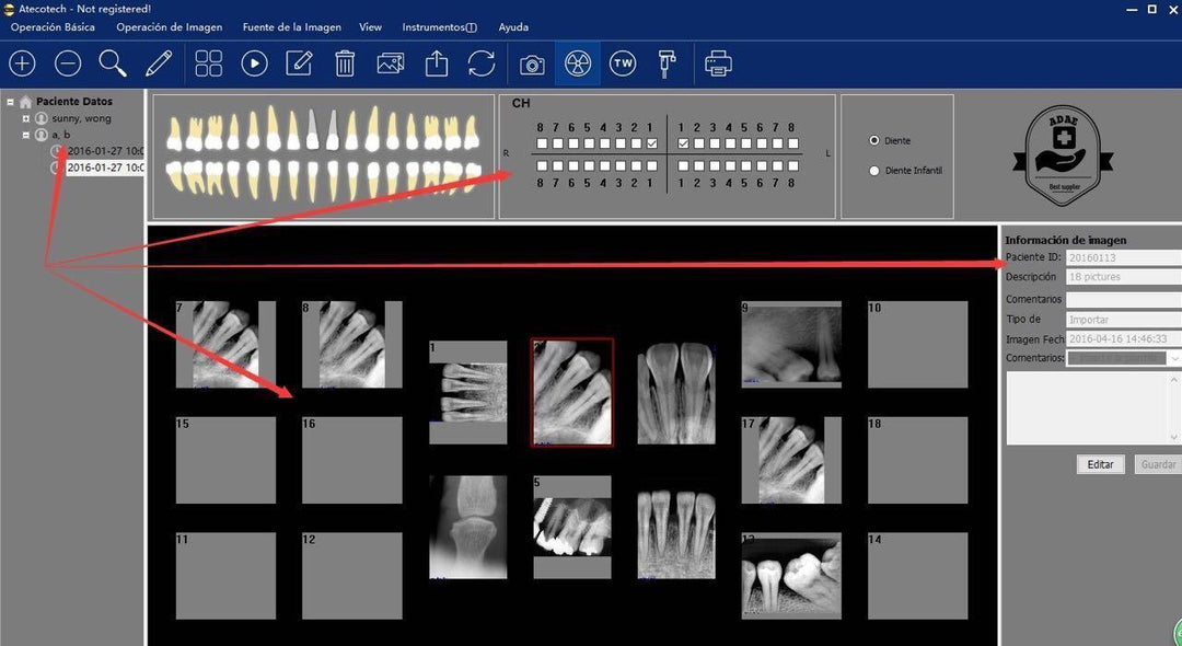 ATECO X-Ray Sensor Driver Software & Calibration Files – Sensor Not Included