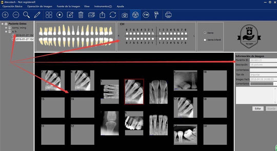 ATECO X-Ray Sensor Driver Software & Calibration Files – Sensor Not Included