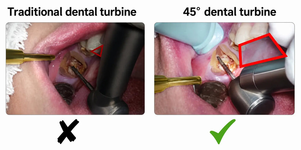 ADAE 45° LED dental turbine