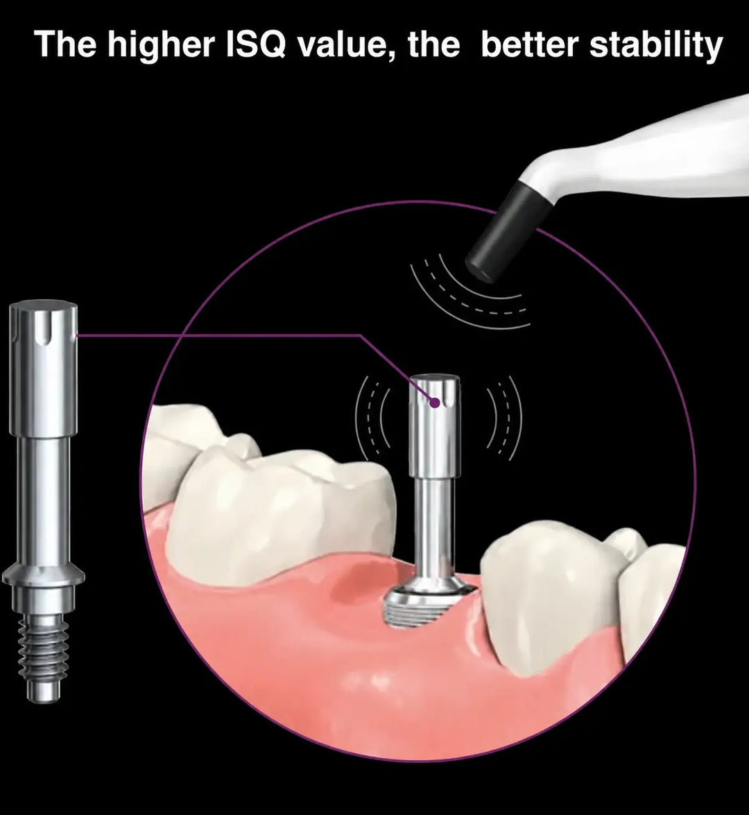 ADAE AD50 Dental Implant Stability Meter-Upgraded version