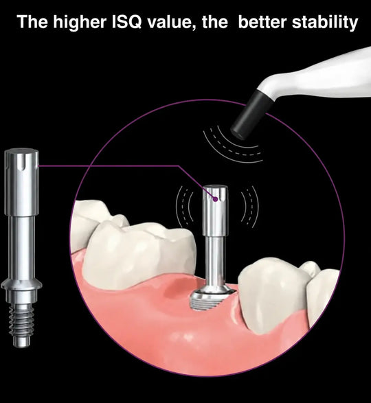 ADAE AD50 Dental Implant Stability Meter-Upgraded version