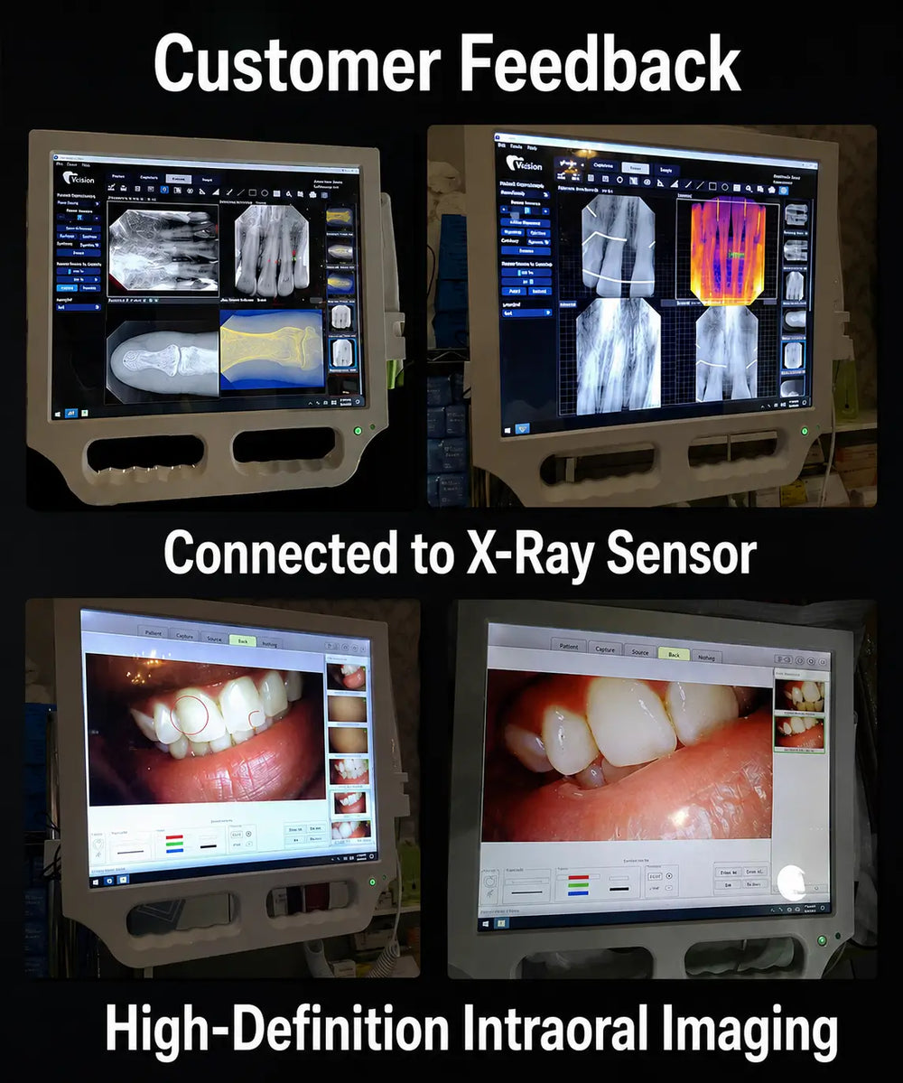 ADAE professional Intraoral camera (4 in one)-Touch screen
