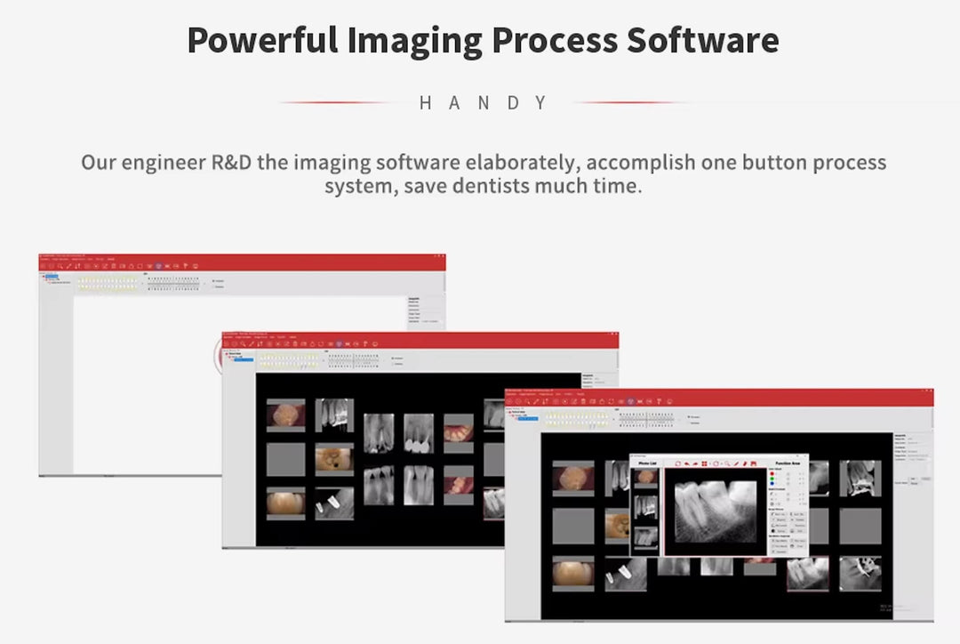 Handy digital imaging plate scanner HDS-500-Upgraded version