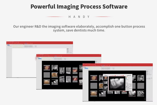 Handy digital imaging plate scanner HDS-500-Upgraded version