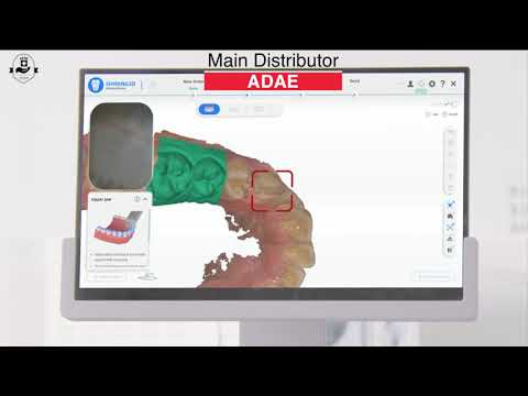 Shining 3D Aoralscan 3 intraoral scanner