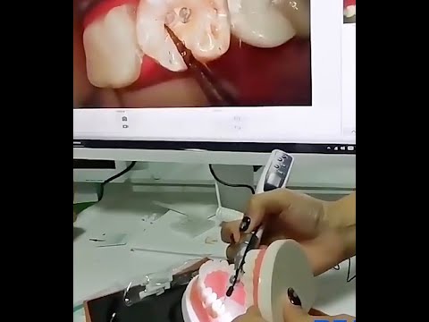 ADAE endodontic micro camera-New release