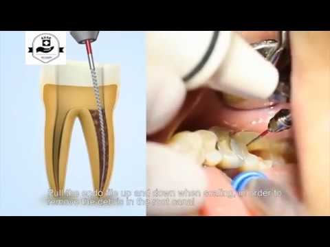 Woodpecker UDS-E-LED dental ultrasonic scaler (with upgraded valves)